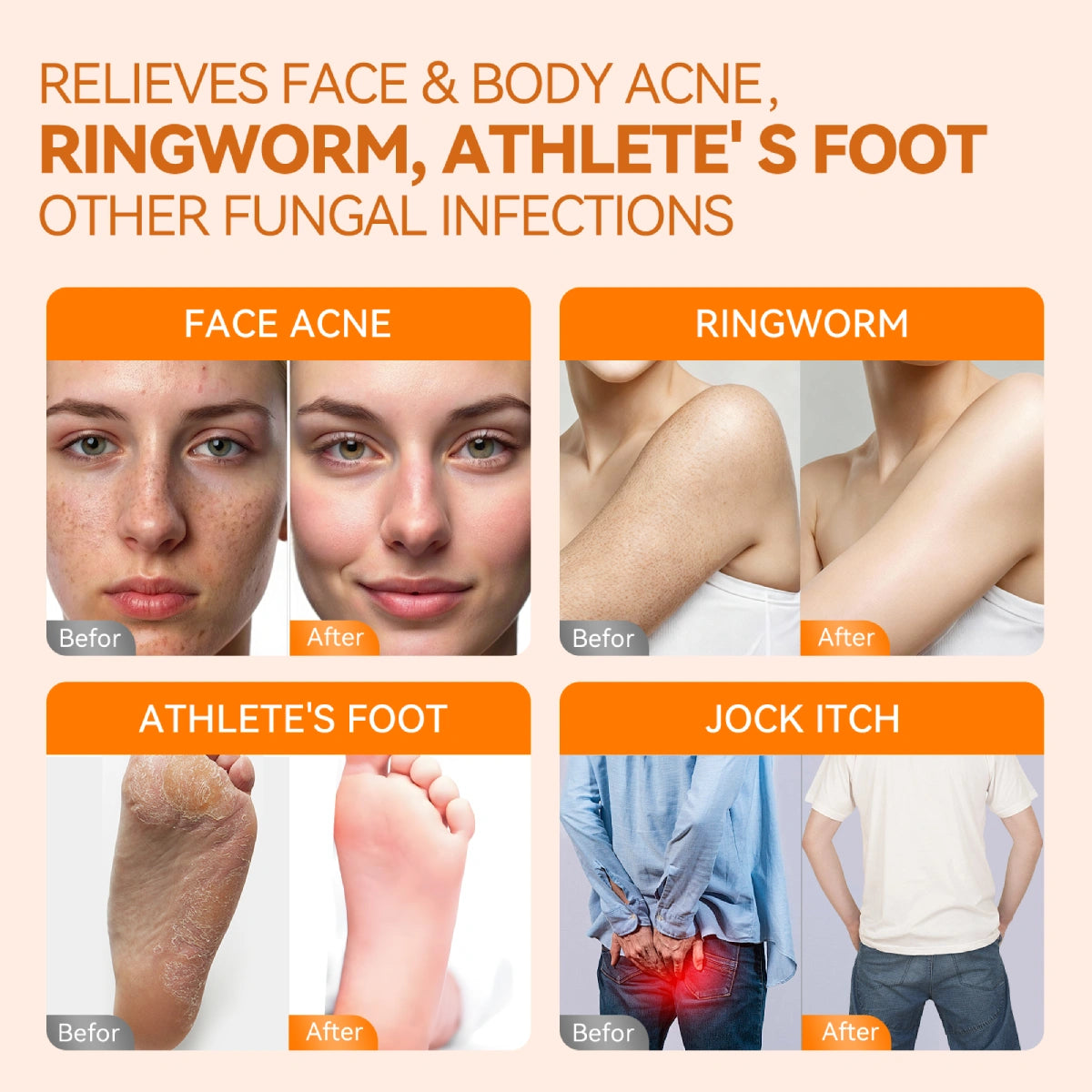 qualiLife_persimmon_antifungal_soap_before_after_display