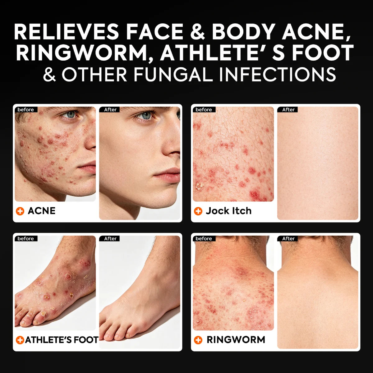 qualilife_charcoal_antifungal_soap_before_after_display
