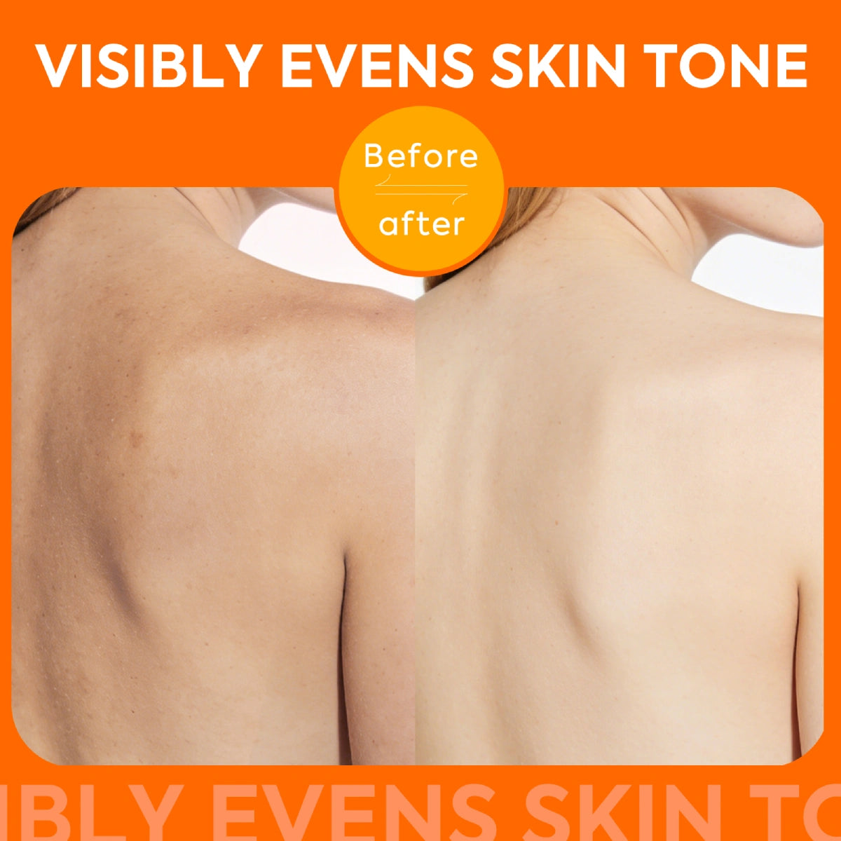 qualilife_mandelic_acid_soap_before_after_display