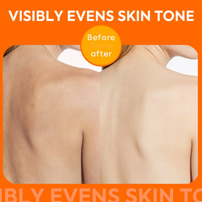 qualilife_mandelic_acid_soap_before_after_display