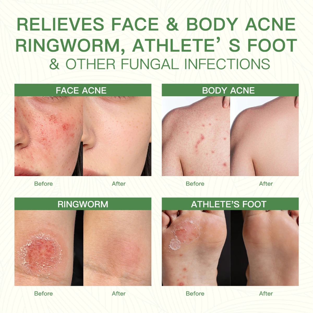 qualilife_tea_tree_soap_before_after_display